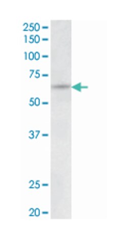 UMOD Goat anti-Human, Polyclonal Antibody, Abnova 100 &mu;g | Buy Online | Abnova Corporation | Fisher Scientific