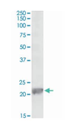 Gpx1 Goat anti-Chicken, Mouse, Rat, Polyclonal Antibody, Abnova 100 &mu;g | Buy Online | Abnova Corporation | Fisher Scientific