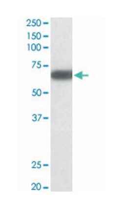 GAD1 Goat anti-Chicken, Dog, Human, Mouse, Pig, Rat, Polyclonal Antibody, Abnova 100 &mu;g | Buy Online | Abnova Corporation | Fisher Scientific