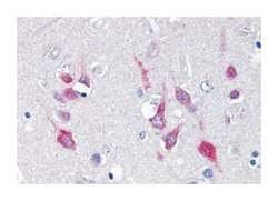 CACNA1C Rabbit anti-Human, Polyclonal Antibody, Abnova 50 &mu;g | Buy Online | Abnova Corporation | Fisher Scientific