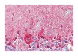 KCNMA1 Rabbit anti-Bovine, Chicken, Dog, Hamster, Human, Monkey, Mouse, Pig, Rabbit, Rat, Xenopus, Zebra fish, Polyclonal Antibody, Abnova 50 &mu;g | Buy Online | Abnova | Fisher Scientific