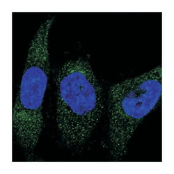 CNPY2 Rabbit anti-Human, Polyclonal Antibody, Abnova 100&mu;L; Unlabeled:Antibodies,