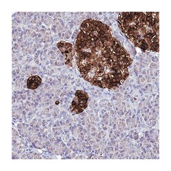 ATPBD4, Rabbit, Polyclonal Antibody, Abnova 100 &mu;L | Buy Online | Abnova Corporation | Fisher Scientific