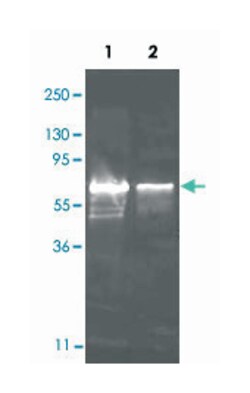 Choline Oxidase, Goat, Polyclonal Antibody, Abnova 100 &mu;g | Buy Online | Abnova | Fisher Scientific