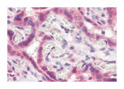 TFF2 Rabbit anti-Human, Polyclonal Antibody, Abnova 50 &mu;g | Buy Online | Abnova Corporation | Fisher Scientific
