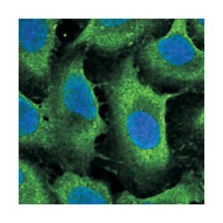 C1orf167, Rabbit, Polyclonal Antibody, Abnova 100&mu;L; Unlabeled:Antibodies,