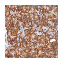 TNFSF12-TNFSF13, Rabbit, Polyclonal Antibody, Abnova 100 &mu;L | Buy Online | Abnova Corporation | Fisher Scientific