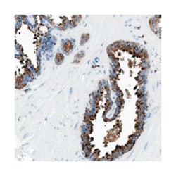 OR14K1, Rabbit, Polyclonal Antibody, Abnova 100 &mu;L | Buy Online | Abnova Corporation | Fisher Scientific