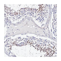 UBE2L3 Rabbit anti-Human, Polyclonal Antibody, Abnova 100&mu;L; Unlabeled:Antibodies,