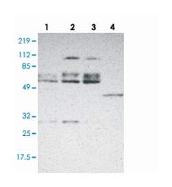 DGCR14 Rabbit anti-Human, Mouse, Rat, Polyclonal Antibody, Abnova 100&mu;L;