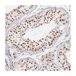 MXD1, Rabbit, Polyclonal Antibody, Abnova 100&mu;L; Unlabeled:Antibodies,