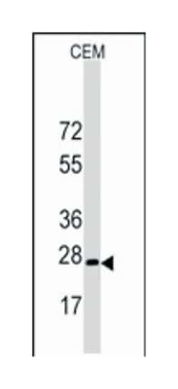 BARX1, Rabbit, Polyclonal Antibody, Abnova 400 &mu;L | Buy Online | Abnova Corporation | Fisher Scientific