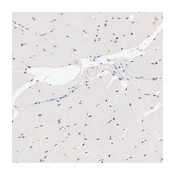 SIX1, Rabbit, Polyclonal Antibody, Abnova 100 &mu;L | Buy Online | Abnova Corporation | Fisher Scientific