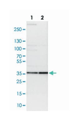 PSMD14, Rabbit, Polyclonal Antibody, Abnova 100&mu;L; Unlabeled:Antibodies,