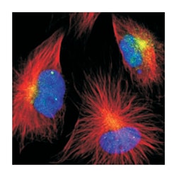 ENTPD5, Rabbit, Polyclonal Antibody, Abnova 100 &mu;L | Buy Online | Abnova Corporation | Fisher Scientific