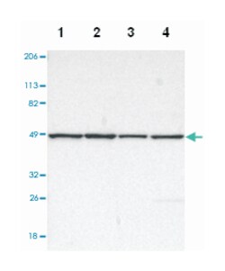 DLST, Rabbit, Polyclonal Antibody, Abnova 100 &mu;L | Buy Online | Abnova Corporation | Fisher Scientific