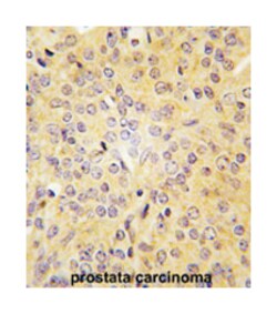 LARS Rabbit anti-Human, Polyclonal Antibody, Abnova 400&mu;L; Unlabeled:Antibodies,