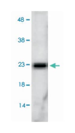 Sod2, Rabbit, Polyclonal Antibody, Abnova 100&mu;g; Unlabeled:Antibodies,