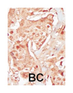 PCTK3, Rabbit, Polyclonal Antibody, Abnova 400 &mu;L | Buy Online | Abnova Corporation | Fisher Scientific