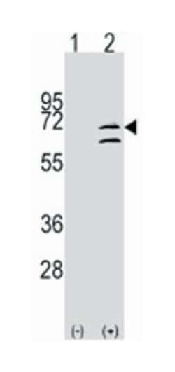 MAPK15 Rabbit anti-Human, Polyclonal Antibody, Abnova 400 &mu;L | Buy Online | Abnova Corporation | Fisher Scientific