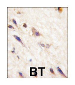 EPHA5 Rabbit anti-Human, Mouse, Polyclonal Antibody, Abnova 400&mu;L; Unlabeled:Antibodies,