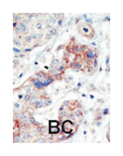 EPHB3, Rabbit, Polyclonal Antibody, Abnova 400 &mu;L | Buy Online | Abnova | Fisher Scientific