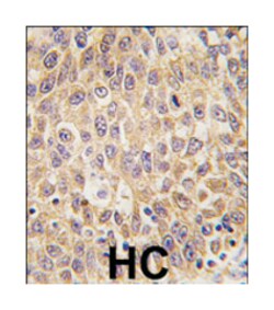 AFP Rabbit anti-Human, Polyclonal Antibody, Abnova 400 &mu;L | Buy Online | Abnova Corporation | Fisher Scientific