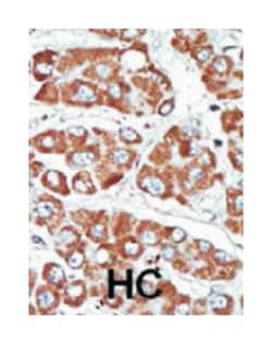 SNF1LK, Rabbit, Polyclonal Antibody, Abnova 400 &mu;L | Buy Online | Abnova Corporation | Fisher Scientific