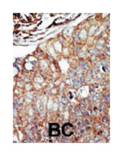 DGKQ Rabbit anti-Human, Polyclonal Antibody, Abnova 400 &mu;L | Buy Online | Abnova Corporation | Fisher Scientific