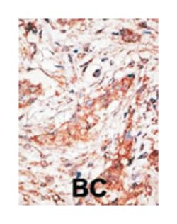 DOK4, Rabbit, Polyclonal Antibody, Abnova 400&mu;L; Unlabeled:Antibodies,