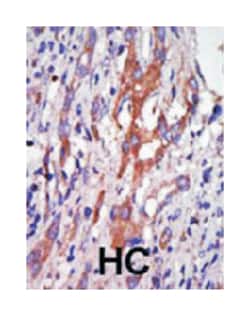 AURKA Rabbit anti-Human, Polyclonal Antibody, Abnova 400 &mu;L | Buy Online | Abnova Corporation | Fisher Scientific