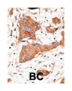 GJA3, Rabbit, Polyclonal Antibody, Abnova 400 &mu;L | Buy Online | Abnova Corporation | Fisher Scientific