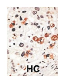GJB3, Rabbit, Polyclonal Antibody, Abnova 400&mu;L; Unlabeled:Antibodies,