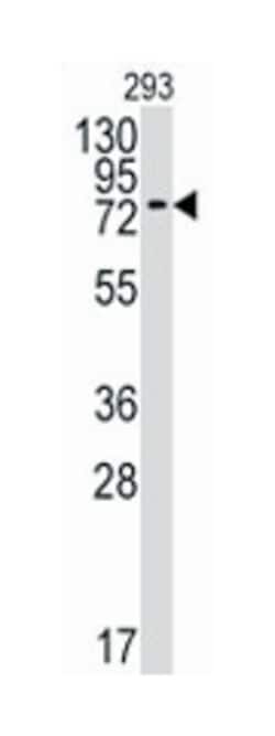 BMPR1A Rabbit anti-Human, Polyclonal Antibody, Abnova 400&mu;L; Unlabeled:Antibodies,