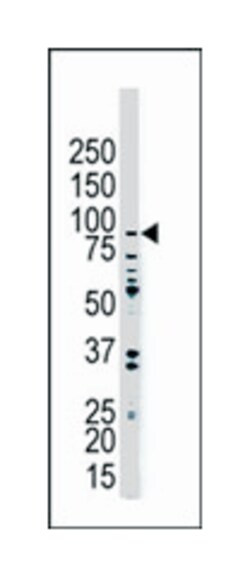 USP8 Rabbit anti-Human, Polyclonal Antibody, Abnova 400 &mu;L | Buy Online | Abnova Corporation | Fisher Scientific