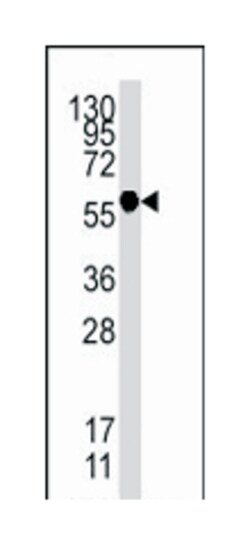 HSF1 Rabbit anti-Human, Polyclonal Antibody, Abnova 400&mu;L; Unlabeled:Antibodies,