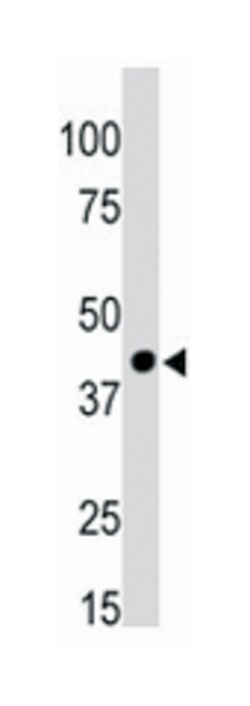 CKMT1A, Rabbit, Polyclonal Antibody, Abnova 400 &mu;L | Buy Online | Abnova Corporation | Fisher Scientific