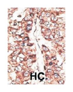 MAGEA11, Rabbit, Polyclonal Antibody, Abnova 400 &mu;L | Buy Online | Abnova Corporation | Fisher Scientific