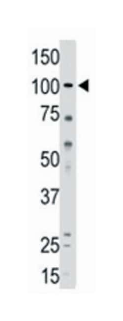 MVP Rabbit anti-Human, Polyclonal Antibody, Abnova 400 &mu;L | Buy Online | Abnova Corporation | Fisher Scientific