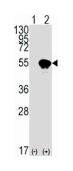 TP53 Rabbit anti-Human, Polyclonal Antibody, Abnova 400&mu;L; Unlabeled:Antibodies,