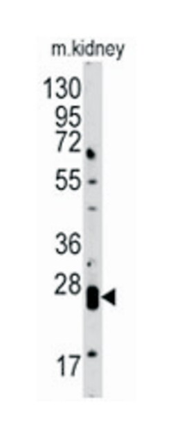 CLDN1 Rabbit anti-Human, Mouse, Polyclonal Antibody, Abnova 400 &mu;L | Buy Online | Abnova Corporation | Fisher Scientific
