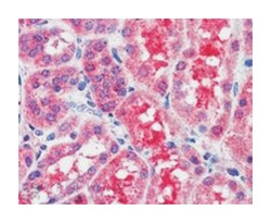 SOCS1, Goat, Polyclonal Antibody, Abnova 100&mu;g; Unlabeled:Antibodies