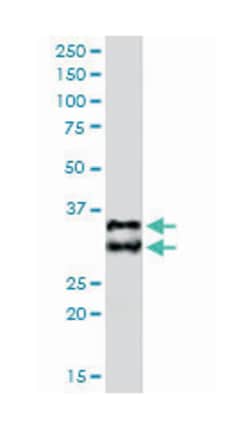 BIRC7, Goat, Polyclonal Antibody, Abnova 100&mu;g; Unlabeled:Antikroppar