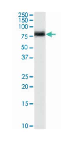 NUMB, Goat, Polyclonal Antibody, Abnova 100&mu;g; Unlabeled:Antibodies,