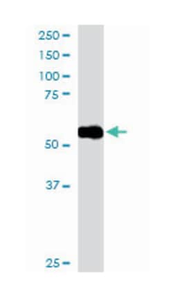 DBNL, Goat, Polyclonal Antibody, Abnova 100&mu;g; Unlabeled:Antibodies,