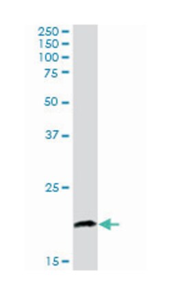 CABP1, Goat, Polyclonal Antibody, Abnova 100 &mu;g | Buy Online | Abnova | Fisher Scientific