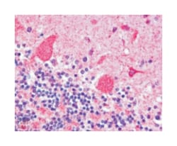 DCTN1, Goat, Polyclonal Antibody, Abnova 100 &mu;g | Buy Online | Abnova Corporation | Fisher Scientific
