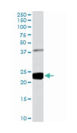 GIPC1, Goat, Polyclonal Antibody, Abnova 100 &mu;g | Buy Online | Abnova Corporation | Fisher Scientific