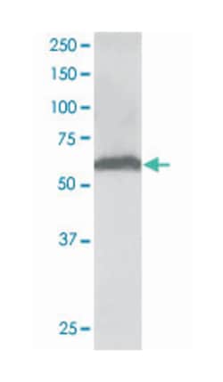FTCD Goat anti-Human, Polyclonal Antibody, Abnova 100&mu;g; Unlabeled:Antibodies,