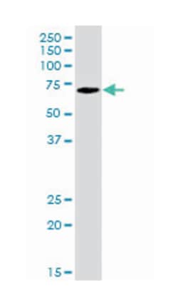 PADI4, Goat, Polyclonal Antibody, Abnova 100 &mu;g | Buy Online | Abnova Corporation | Fisher Scientific